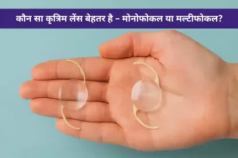 मोनोफोकल लेंस और मल्टीफोकल लेंस में अंतर - कौन सा कृत्रिम लेंस बेहतर है?