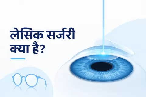 लेसिक सर्जरी क्या है? फायदे, नुकसान, प्रक्रिया, लागत और रिकवरी