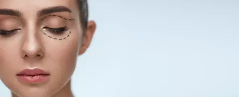 Cosmetic Eye Surgery Risks and Safety