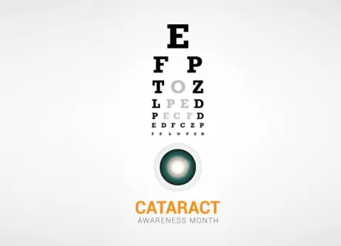 Robotic Cataract Surgery Explained: Procedure, Benefits & Cost