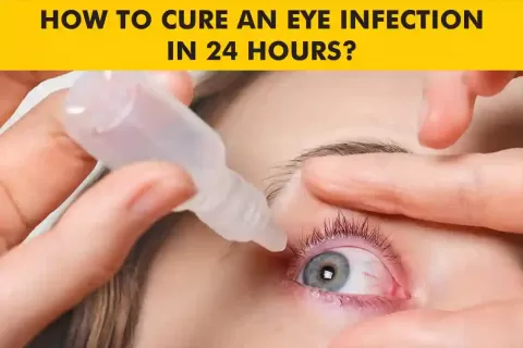 Eye Infection Treatment: Causes, Remedies, and Prevention