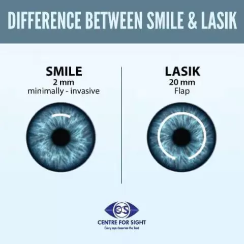SMILE vs LASIK ? Differences, Cost, and Recovery