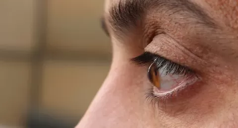 Keratoconus Eye Disorder: Types, Signs, and Treatments