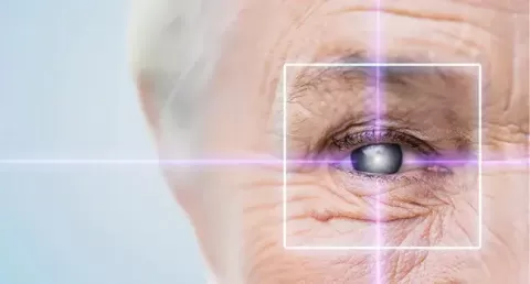 Cataract Eye Surgery with Glaucoma: Is It Safe?