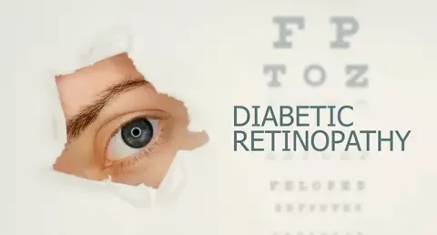What Is Diabetic Retinopathy? Learn All About It!