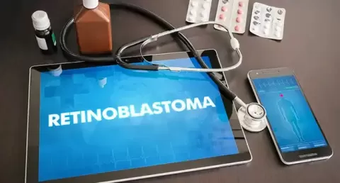 Retinoblastoma in Children: Symptoms, Stages and Diagnosis