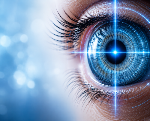 Cataract Surgery