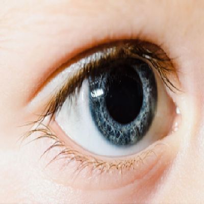 Phacoemulsification procedure
