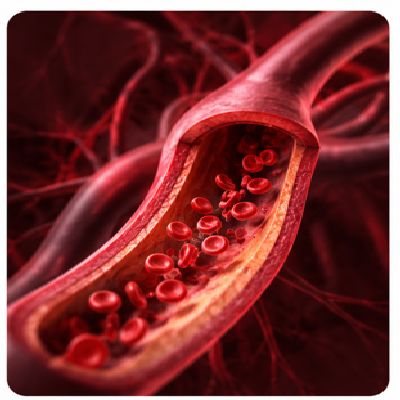 Cataract Vascular-Conditions