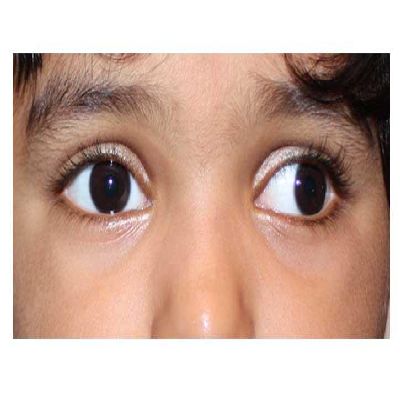 Childhood Conditions