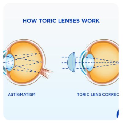 Toric Lens